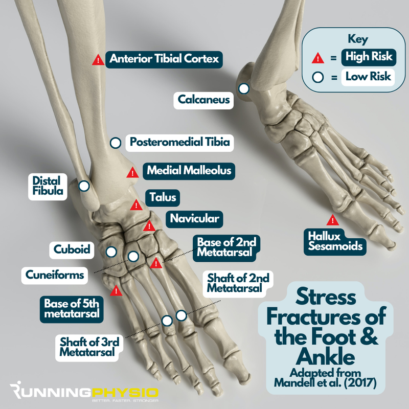 infographic listing stress fractures of foot and ankle